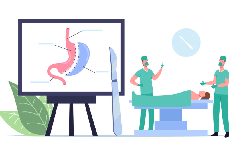 Best gastro surgeon in Kalyan